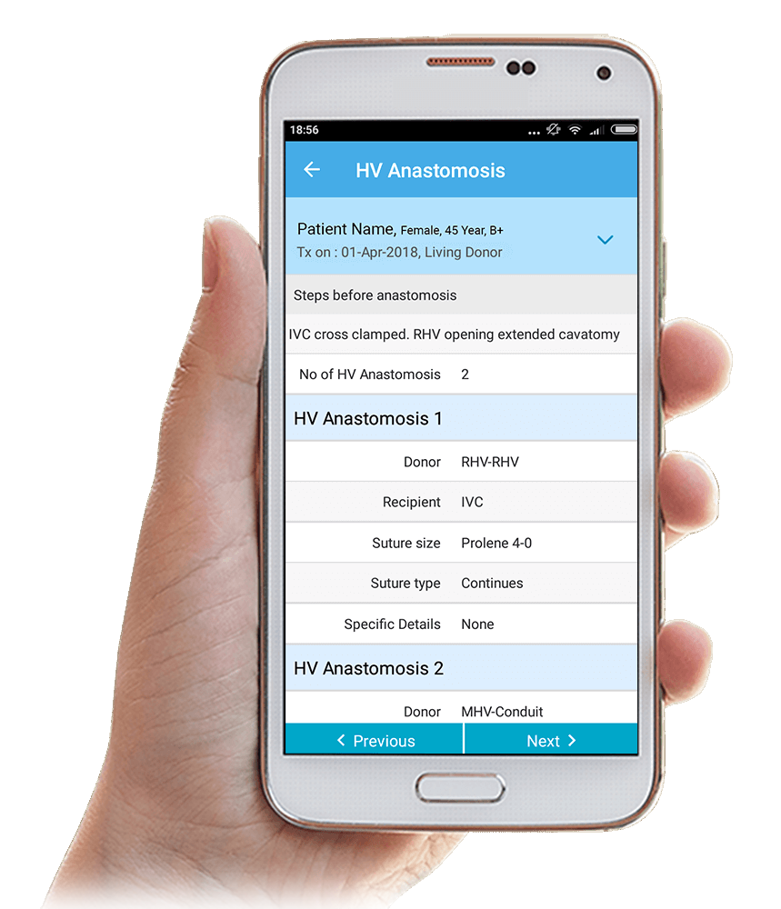 Liver transplant surgeru notes GridSense Health app for managing surgery notes stright out of the OT